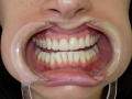Los Angeles Cosmetic Dentist